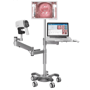 Video Colpsocopio EDAN C6A HD Equipo Medico Vial Medic